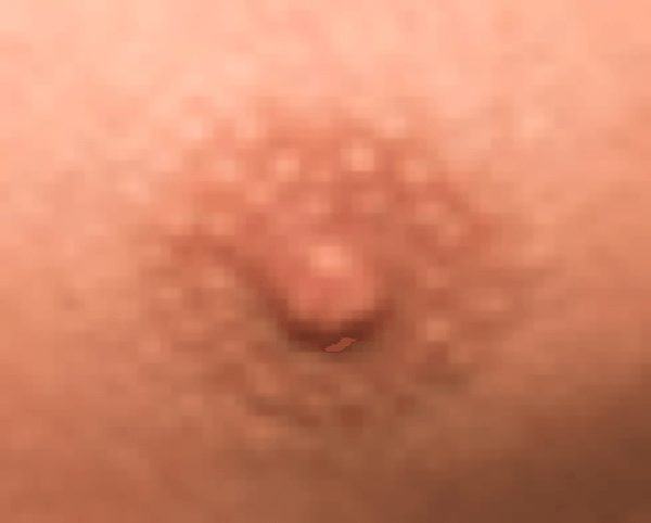 Can you identify these WWE Superstars by extreme close-ups of their left nipples?