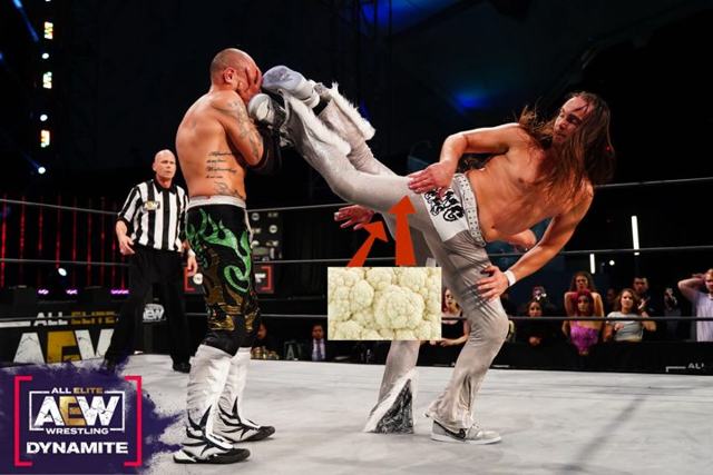 Young Bucks hospitalized with cauliflower thigh