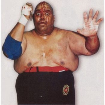 Abdullah the Butcher stubs toe, bleeds from forehead