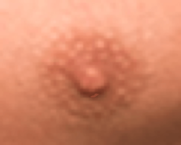 Can you identify these WWE Superstars by extreme close-ups of their left nipples?