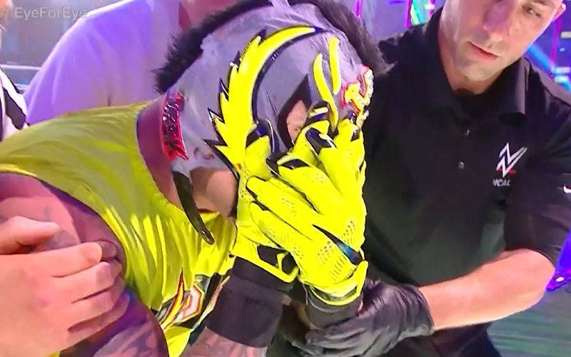 Rey Mysterio permanently blinded to entertain you disgusting, bloodthirsty monsters