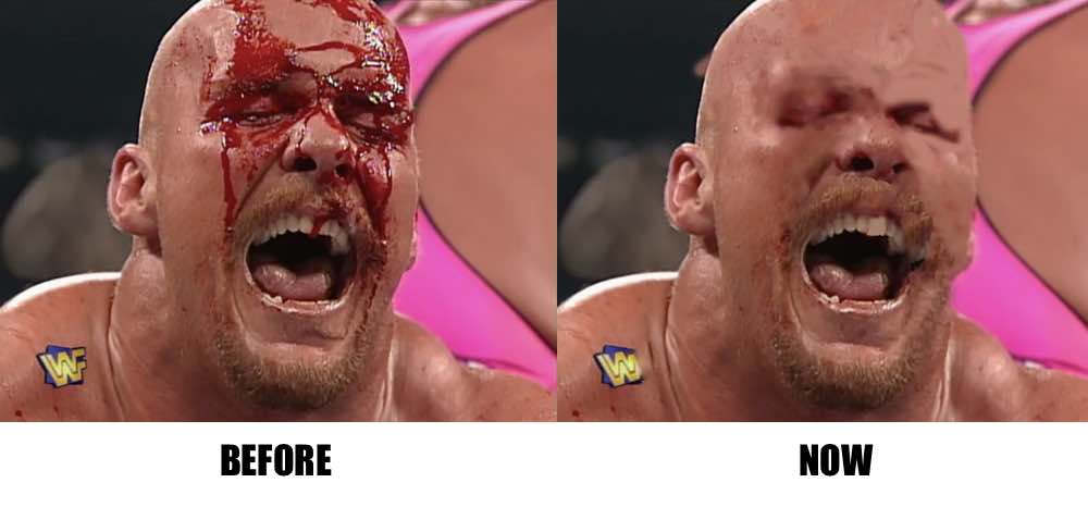 austin bleeding